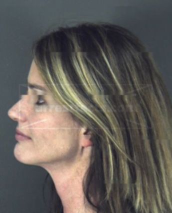 Tammi Wagner Jacobs