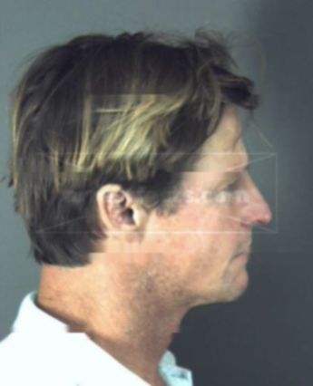 Christopher Thomas Jacobs