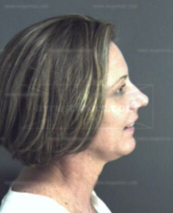 Connie Hawkins Henderson