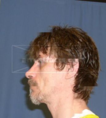 Christopher D Baker