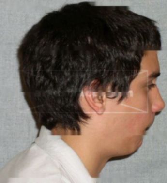 Justin David Landis