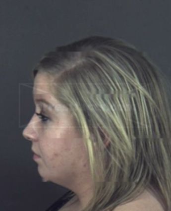 Ashton Lea Brewer
