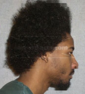 Samuel K Dixon