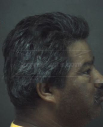 Jose Louis Lopez