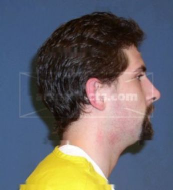 Andrew Feyereisen