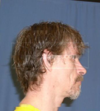 Christopher D Baker