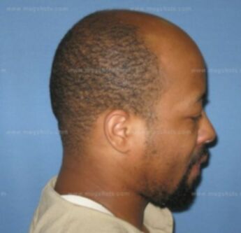 Derrick Riggins