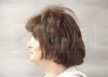 Loretta J Kittelson