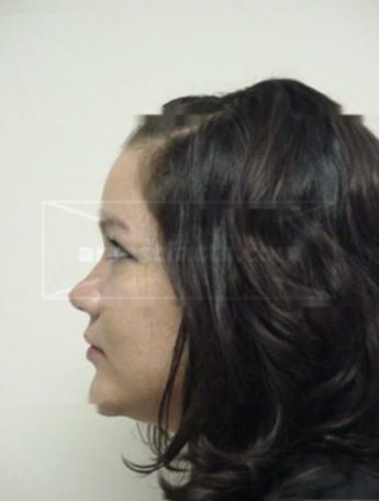 Erin J Oscarson