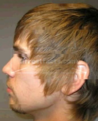 Anthony Paul Layton