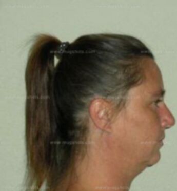 Kimberly D Kitzman