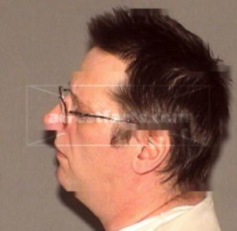 Lorren Arthur Hagen