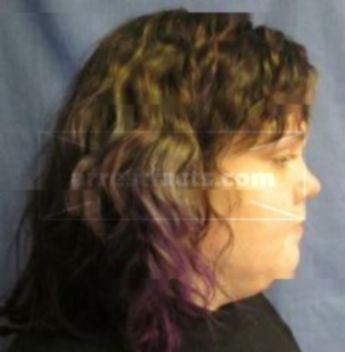 Chelsea M Stigleman
