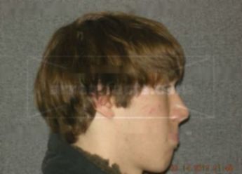 Michael J Kulzer
