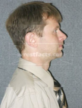 Michael D Ruckert
