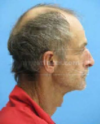 Clarence Thomas Pelham