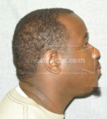 Lanier K Franklin