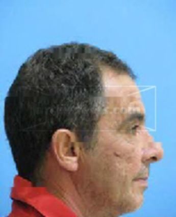 Bernardo Pujol