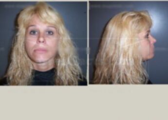 Cheri Lynn Miller