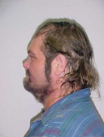 Troy T Craighead