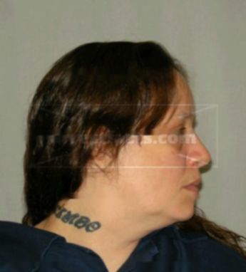 Debra A Fernandez