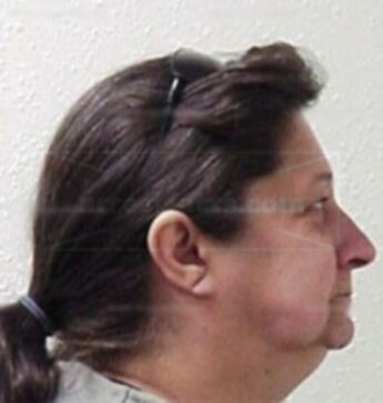 Lu Ann L Bronstad