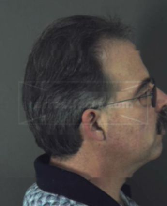 Francis J. Burke Iii