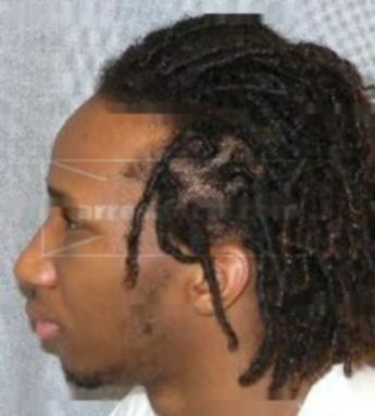 Lanarius Travell Hodges