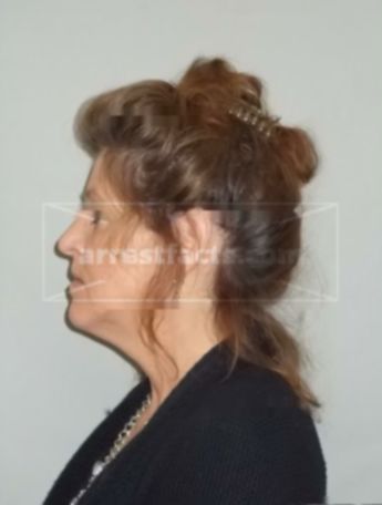 Teresa L Oliphant