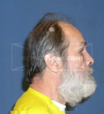 Virgil D Holsten