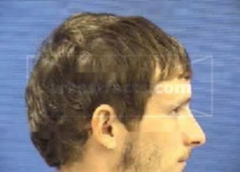 Chance Allen Maynard