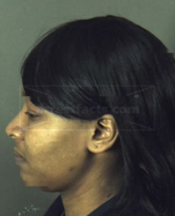 Meia Deon Parker