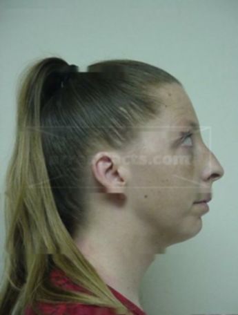 Katie T Uecker