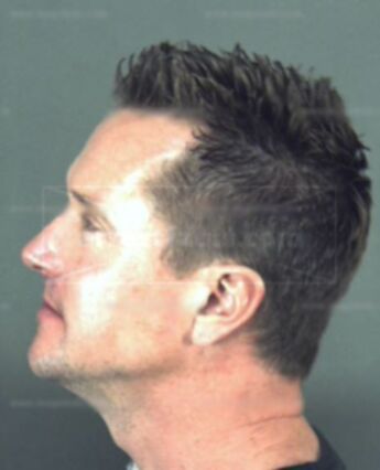 Michael James Blackley