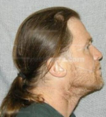 Gary Leonard Simmerling
