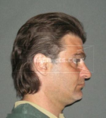 Tony A Nowakowski