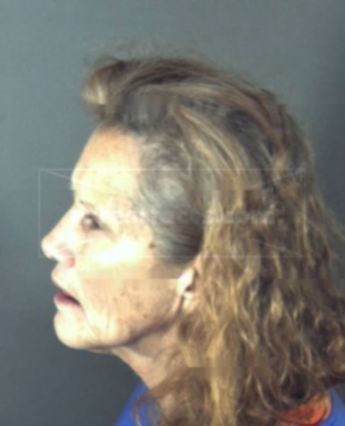 Patricia Ann Remmick