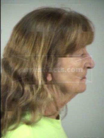 Irene M Direnzo