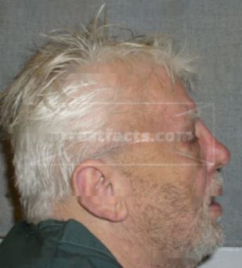 Ronald F Rieckhoff