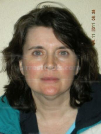 Lori J Knoke