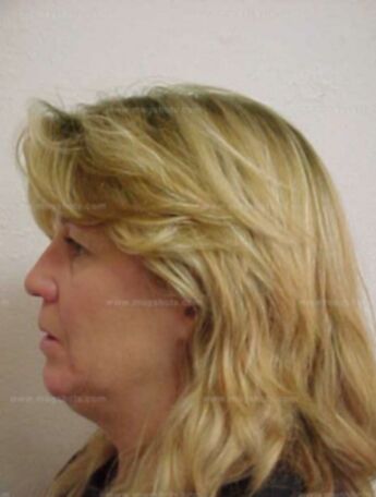 Debra Chancey