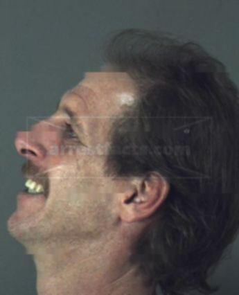 Todd James Kinsey