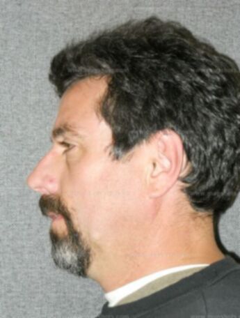 Timothy C Schuerman