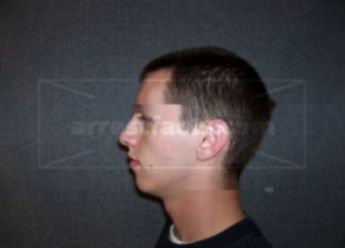 Jonathon L Terrill