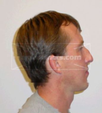 Troy T Brummer