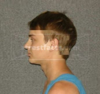 Tanner M Diercks