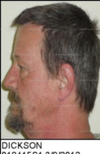 Michael Wayne Dickson