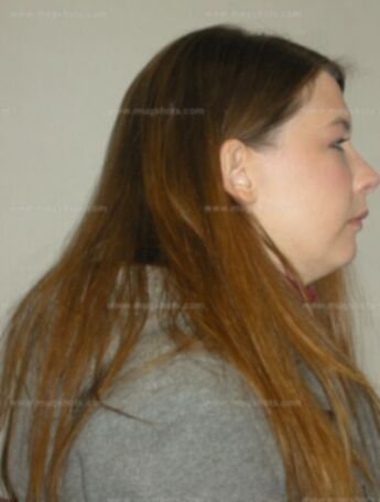 Kristine A Vetter