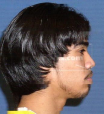 Emmanuel G Martinez
