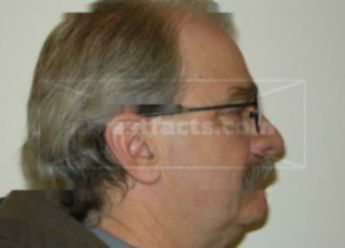 Gerald R Eisch